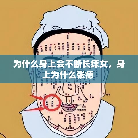 为什么身上会不断长痣女,身上为什么张痣