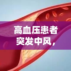 高血压患者突发中风，应对方法与预防措施详解