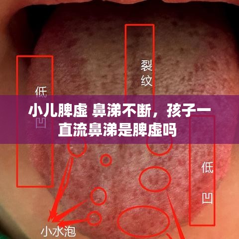 小儿脾虚 鼻涕不断，孩子一直流鼻涕是脾虚吗 