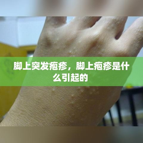 脚上突发疱疹,脚上疱疹是什么引起的