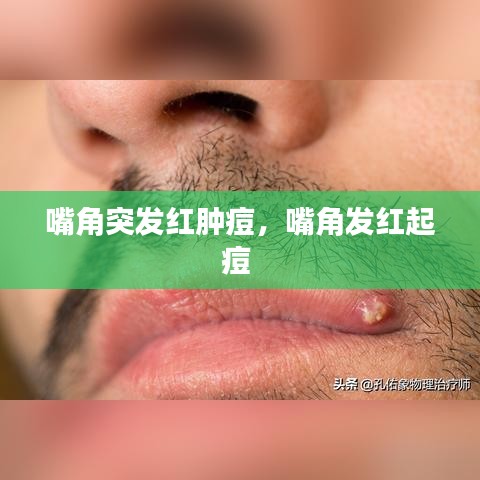 嘴角突发红肿痘,嘴角发红起痘