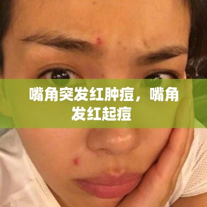 嘴角突发红肿痘,嘴角发红起痘