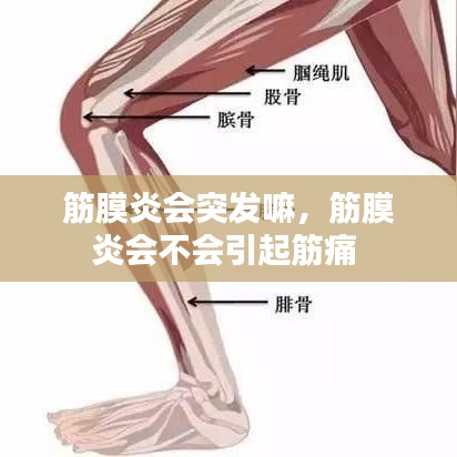 筋膜炎会突发嘛,筋膜炎会不会引起筋痛