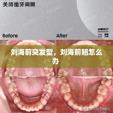 刘海前突发型，刘海前翘怎么办 