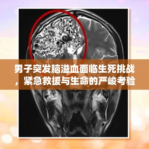 男子突发脑溢血面临生死挑战,紧急救援与生命的严峻考验