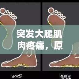 突发大腿肌肉疼痛,原因解析、应对方法与预防措施