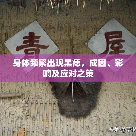 身体频繁出现黑痣,成因、影响及应对之策