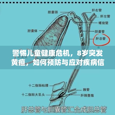 警惕儿童健康危机，8岁突发黄疸，如何预防与应对疾病信号？
