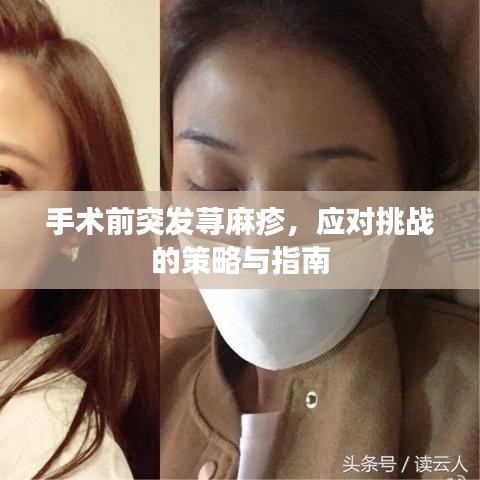 手术前突发荨麻疹,应对挑战的策略与指南