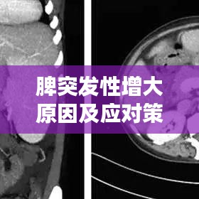 脾突发性增大原因及应对策略