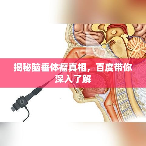 揭秘脑垂体瘤真相,百度带你深入了解